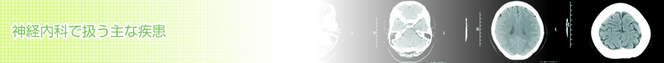 神経内科で扱う主な疾患 ｜わたなべ内科クリニック｜ 宮城県登米市の内科・神経内科・リハビリテーション科